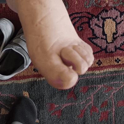 Fini les gonflements douloureux